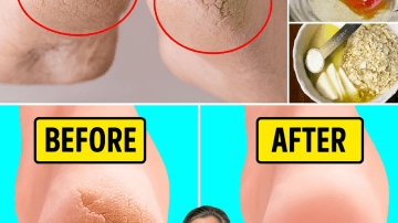 Flush Toxins and Revive Your Kidneys: 8 Natural Ways to Boost Vitality