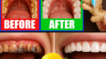 🌿 Could This 3-Ingredient Remedy Banish Sinus Congestion and Dizziness Overnight?