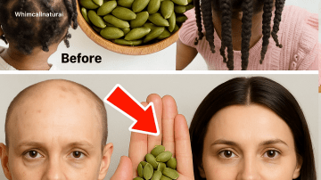 🌿 Could This 3-Ingredient Remedy Banish Sinus Congestion and Dizziness Overnight?